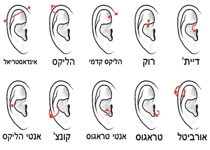 בעיות בהחלמה בעגילי סחוס